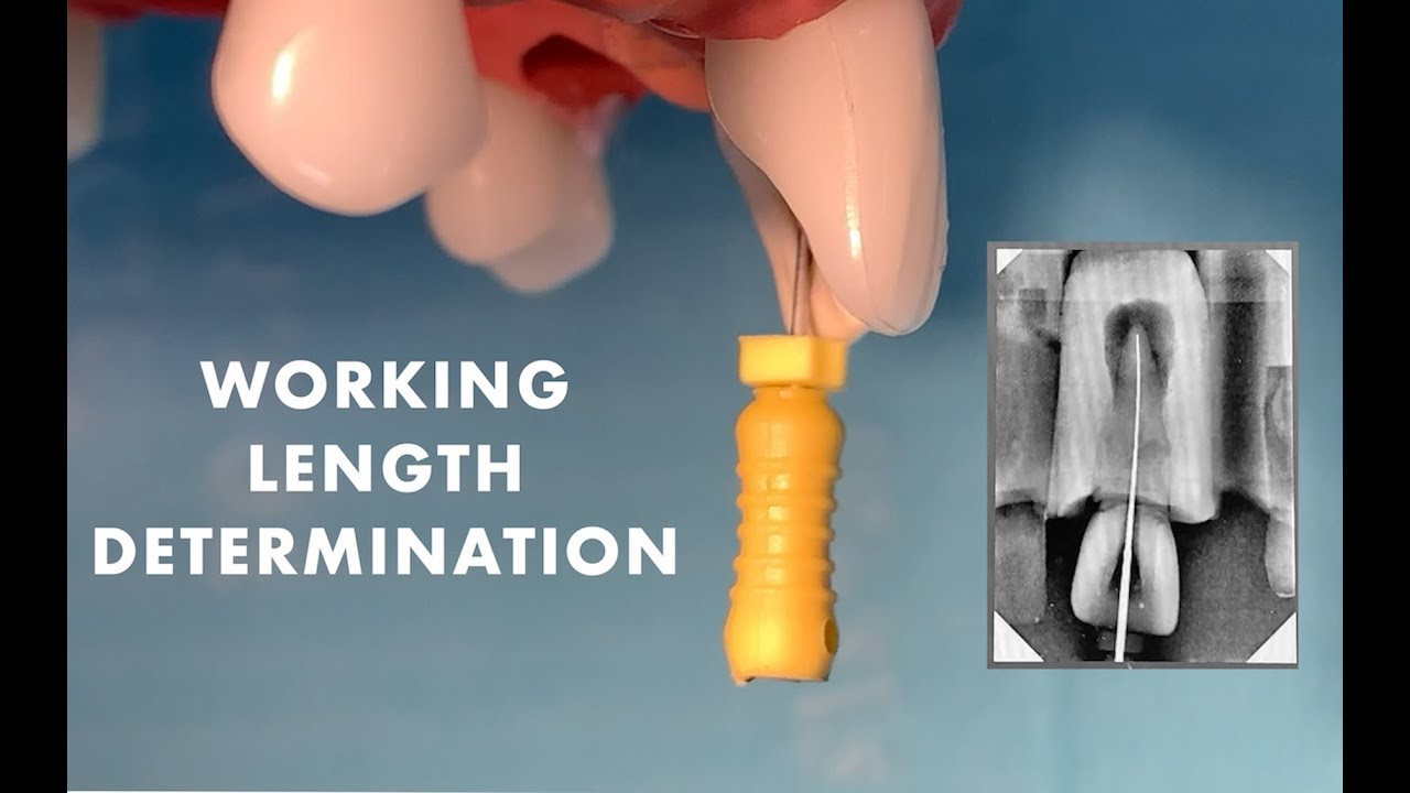 Preclinical laboratory demonstration - working length determination