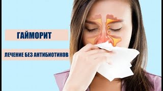 Гайморит лечение без антибиотиков GIGRI.RU