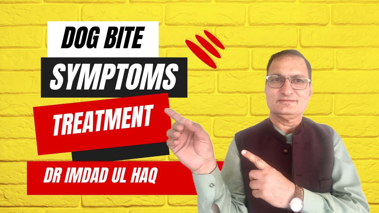 Rabies Dog bite Rabies Symptoms Rabies Treatment Dr Imdad ul
