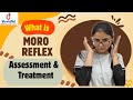 What is Moro reflex| Reflex integration| Treatment for Moro reflex| @VrridhiChildTherapycenter