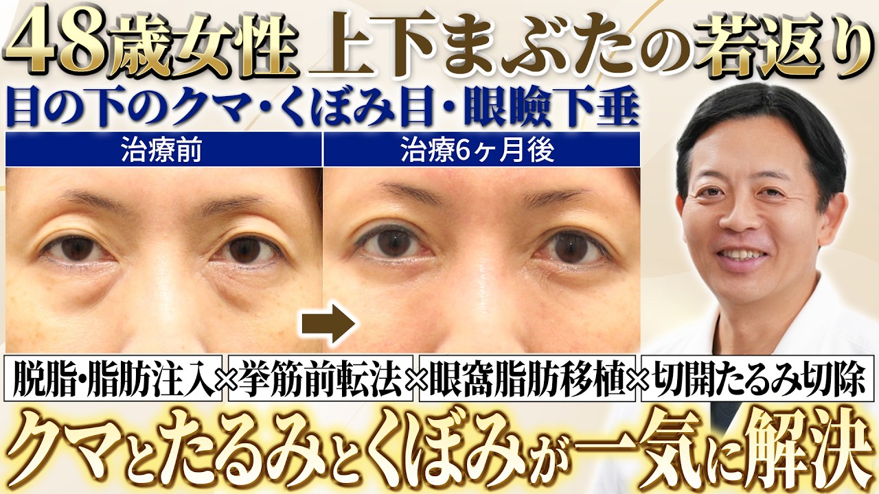 クマ取り】目元が別人級にガラリと若返る！目周り施術のフルコースを 