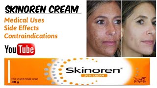 Skinoren Cream | Medical Uses | Face Whitening Agent