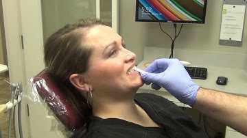 Leaf Guage CR Record Technique TEAM ACT