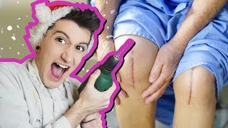 VÁNOČNÍ OPERACE KOLENE 😨 ! ( Knee Surgery GAME )