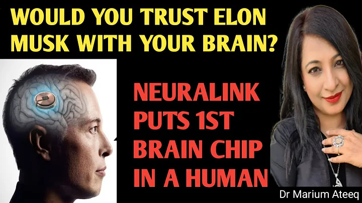 ELON MUSK'S NEURALINK  IMPLANTS FIRST CHIP IN HUMAN BRAIN.