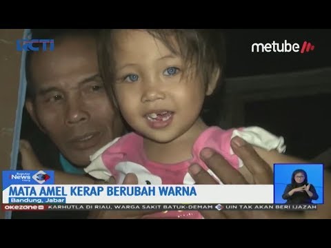 Video: Bagaimana Warna Mata Anak-anak Berubah Seiring Bertambahnya Usia