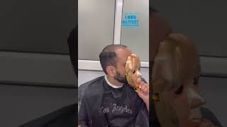 From Scanty Hair to a Full Head of Hair in Just 2 Hours | Before & After Short of Hair Patch Fixing