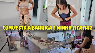 45 DIAS DE PÓS CIRÚRGICO | COMO ESTÁ MINHA BARRIGA PÓS ABDOMINOPLASTIA E MASTOPEXIA COM PRÓTESE | 