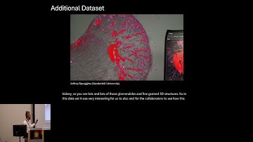 The Best of Both Worlds: Blending Mixed Reality and 2D displays... - Eric Mörth - BioVis - ISMB 2024