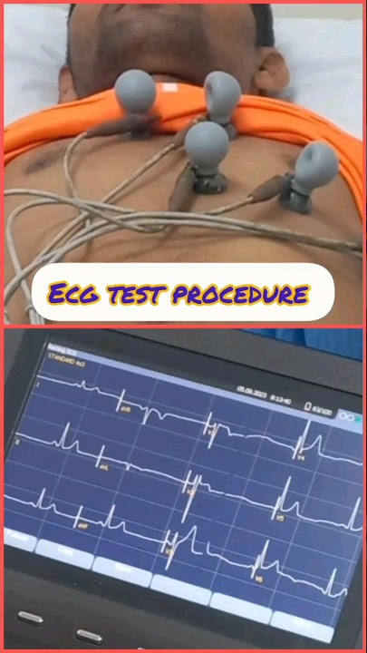 How to perform an ECG #shorts #medical #ecg