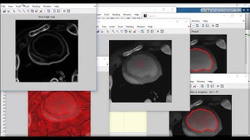Project on matlab for engineering students