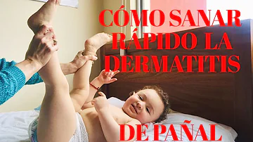 ¿Qué toallitas son mejores para la dermatitis del pañal?