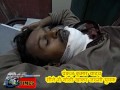 Bullet in Chest  Injured man Madhepura Times