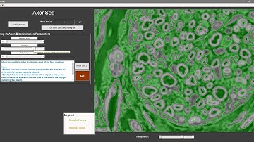 MATLAB Axon Segmentation Installation and Tutorial