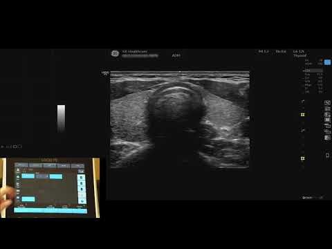 LOGIQ P9 Tutorials: