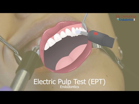 Electric Pulp Testing