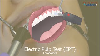 Electric Pulp Testing My Dental Key