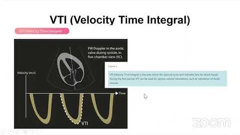SIÊU ÂM CÓ TRỌNG ĐIỂM TẠI CẤP CỨU | BSCKI. LÊ CÔNG THUYÊN