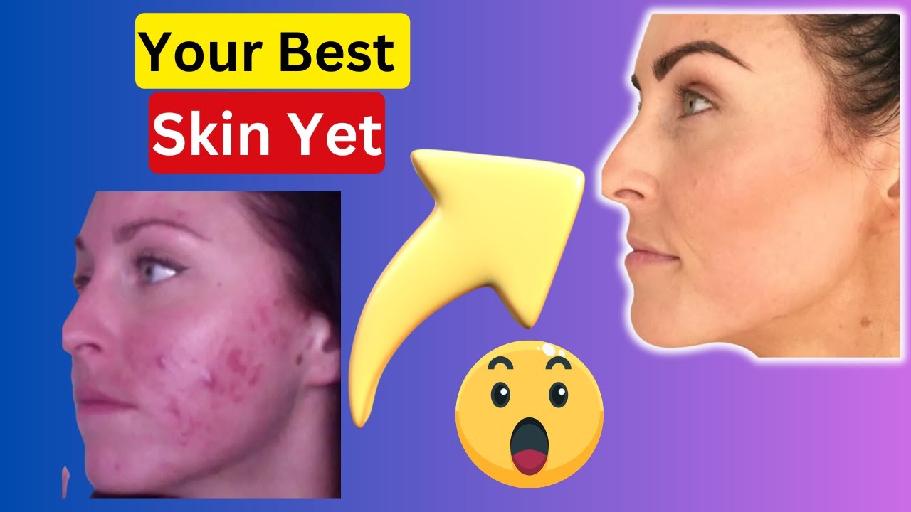Ultimate Skincare Routine Guide Morning & Night Steps for Glowing Skin ...
