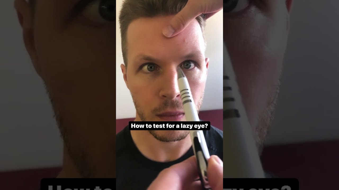 How To Test For A Lazy Eye 