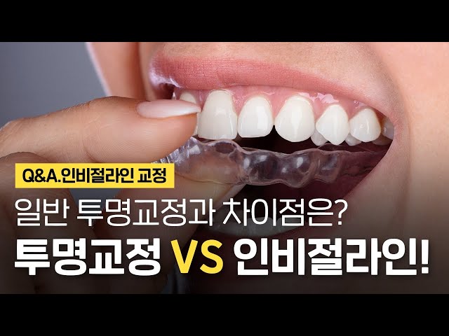 인비절라인 VS 투명교정! 둘 다 똑같다⁉️ 투명교정과 인비절라인의 차이점 ⏰1분 치아상식!!