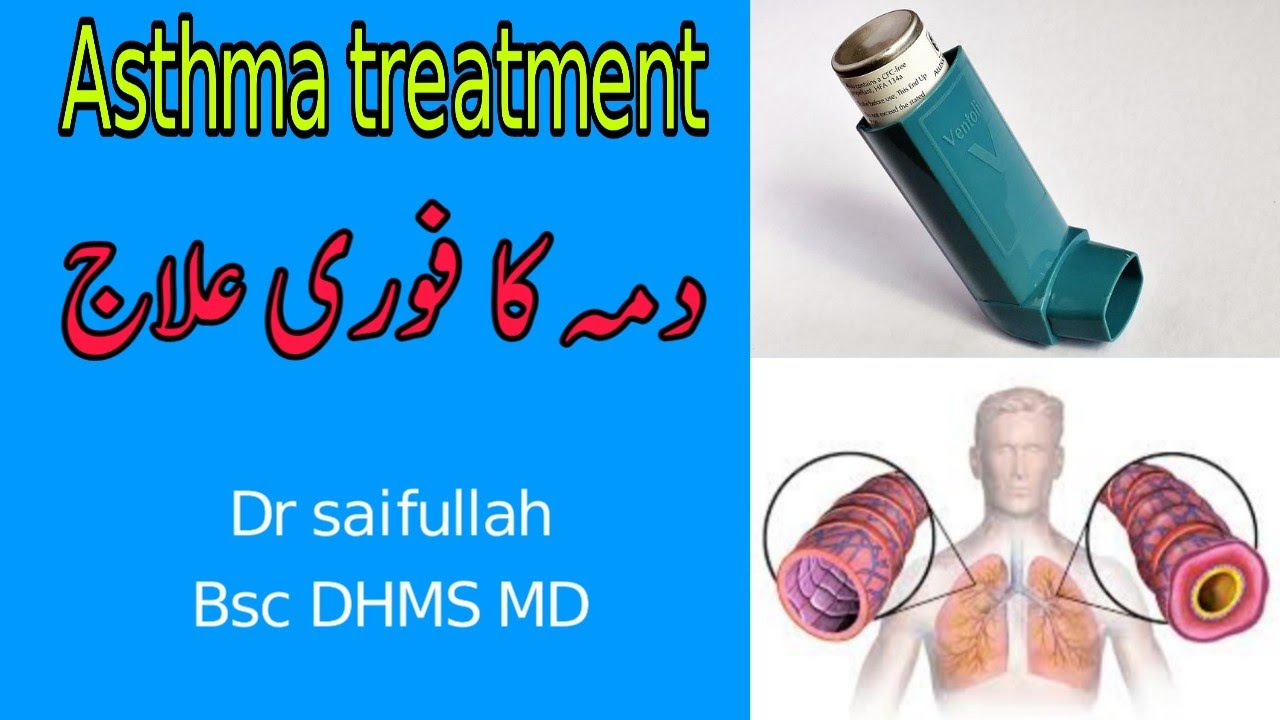 Homeopathic medicine for asthma asthma dama ka ilaj in urdu hindi