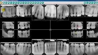 DEXIS Imaging Suite - Patient Screen Overview