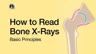 How to Read Bone X-Rays screenshot 5