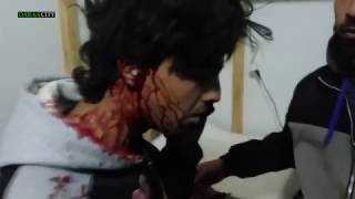 سقوط عدد من الجرحى جراء استهداف الطيران الروسي أحياء درعا البلد