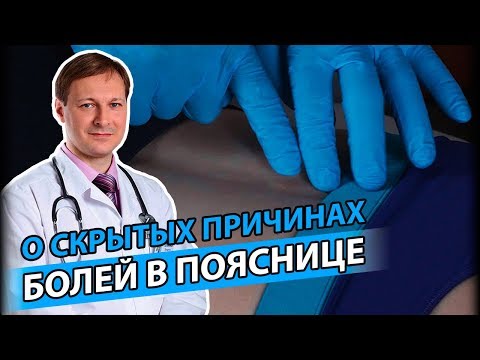 БОЛЬ В ПОЯСНИЦЕ | Маленькая причина большой боли в пояснице