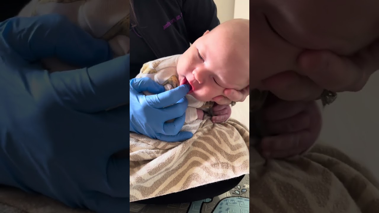 How to get baby to suck on pacifier: Bringing Baby's Jaw Forward #baby #pacifier #infantsuck