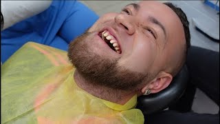 Naar Turkije Voor Een Nieuw Gebit - Tijdelijke Facings - De Allerwitste Tanden