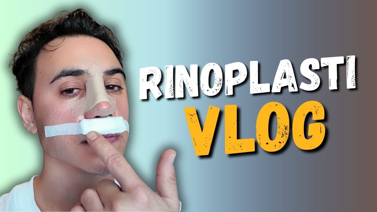 BURUN AMELİYATI OLDUM ︱TÜM SÜREÇ