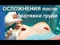 ВАЖНО! 🆘 Подтяжка грудей | ОСЛОЖНЕНИЯ