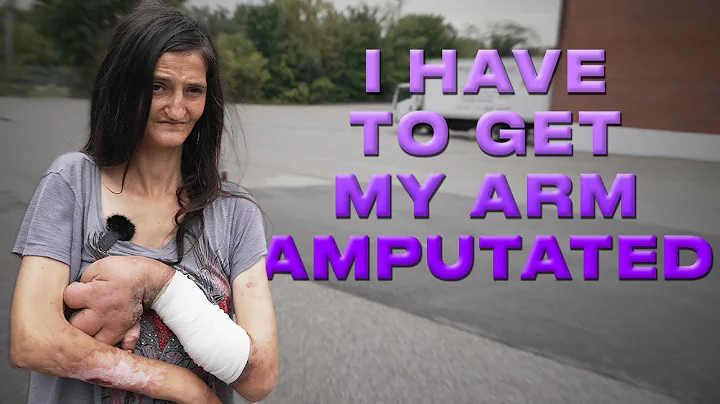 "The Heroin Is Eating My Skin From The Inside Out." | A drug addict interview in Baltimore, MD (4K)