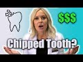 Chipped a Tooth? 4 Tips on What To Do