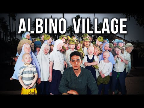 Visiting the Secret Albino Village in Tanzania (Too White to Live)