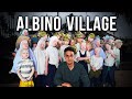 Visiting the secret albino village in tanzania too white to live