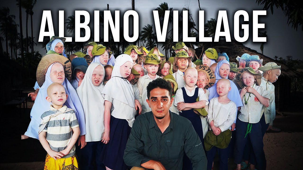 ⁣Visiting the Secret Albino Village in Tanzania (Too White to Live)