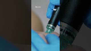 Hydrafacial Syndeo | Dermatología MD Clinic Panamá