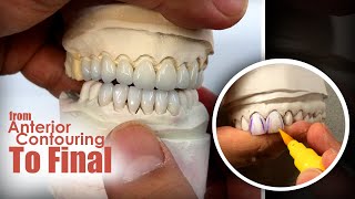 Step-By-Step From Anterior Contouring to Final