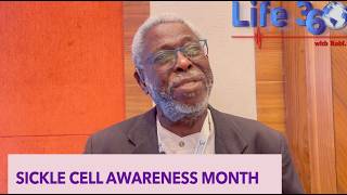 75 YEARS OF SICKLE CELL