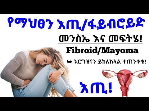 ቪዲዮ: ፋይብሮይድ የት ይገኛል?