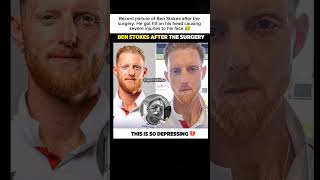 Shocking! Ben Stokes After Surgery 😥💔 | Serious Head Injury Update