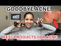 Best products for acne prone skin  banish for acne and scars