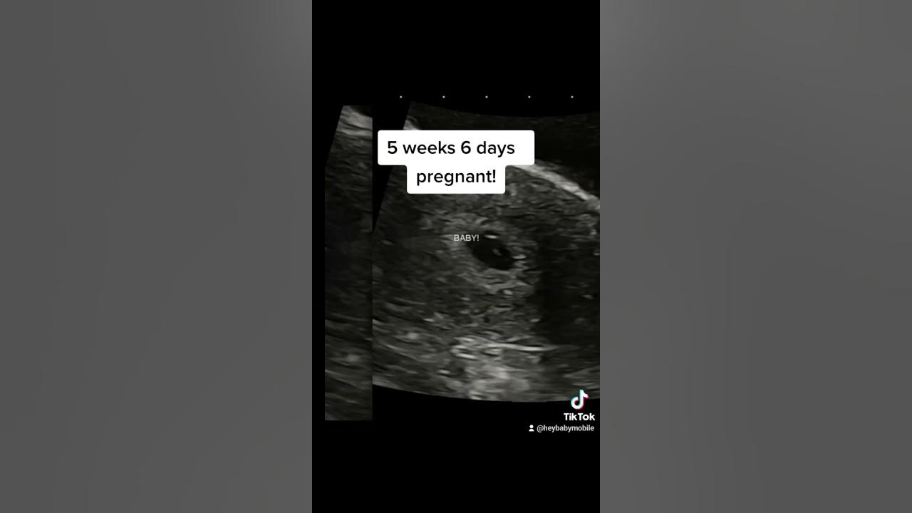 5 weeks 6 days pregnant! Baby is 3 mm- check out the ultrasound! - YouTube