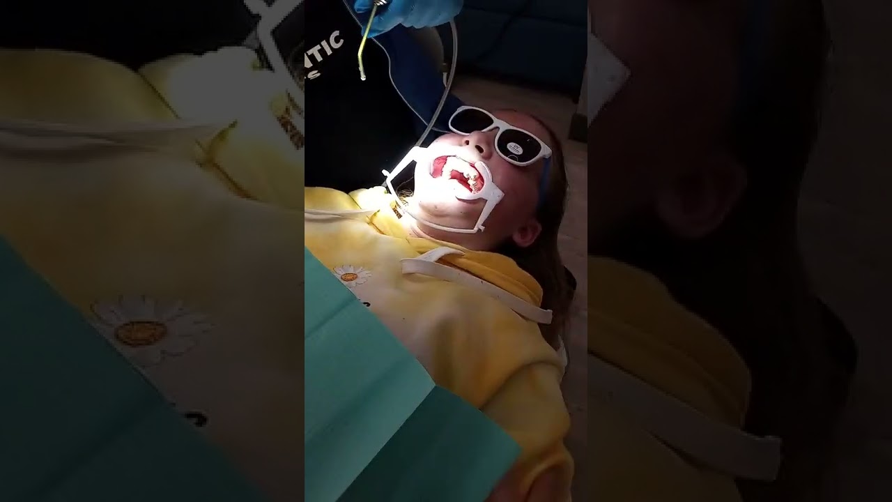 braces yay 2 22 2Q22 at 2222