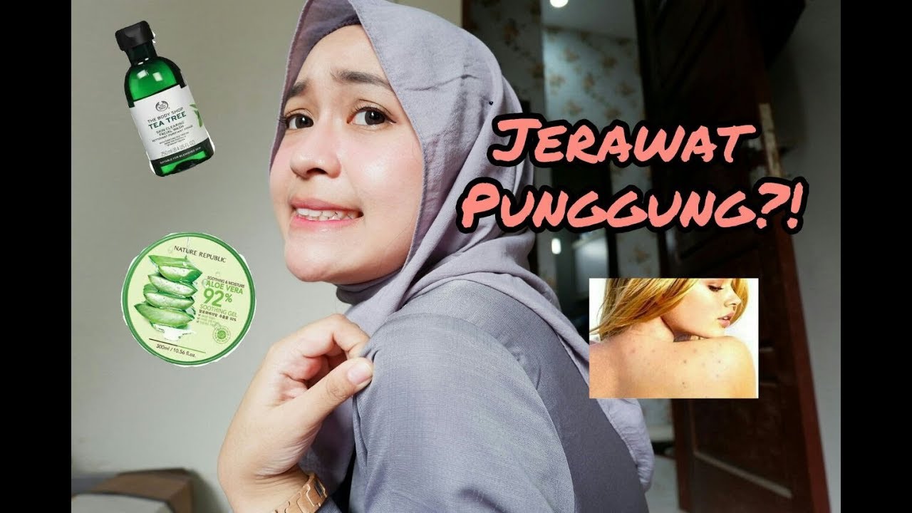 NGILANGIN JERAWAT PUNGGUNG TERSIMPEL | HOW TO RID BACK ACNE!! 