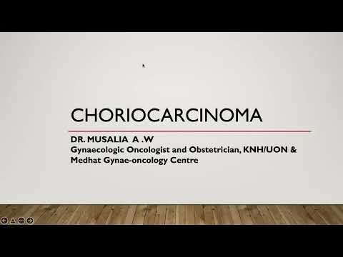वीडियो: क्या कोरियोकार्सिनोमा एक प्रकार का कैंसर है?