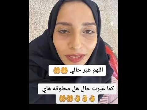 بنين الموسوي قبل عمليات تجميل وبعد عمليات عني يابه عني